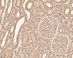 CREBBP Antibody in Immunohistochemistry (Paraffin) (IHC (P))