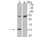 GLP-1R Antibody in Western Blot (WB)