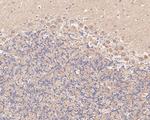 NMDAR2B Antibody in Immunohistochemistry (Paraffin) (IHC (P))