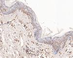DP2 Antibody in Immunohistochemistry (Paraffin) (IHC (P))