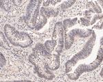 DP2 Antibody in Immunohistochemistry (Paraffin) (IHC (P))