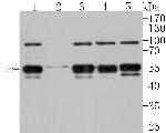 DP2 Antibody in Western Blot (WB)