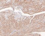 Endofin Antibody in Immunohistochemistry (Paraffin) (IHC (P))