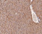 MAT1A Antibody in Immunohistochemistry (Paraffin) (IHC (P))