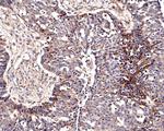 ChT1 Antibody in Immunohistochemistry (Paraffin) (IHC (P))