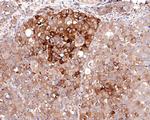 Met (c-Met) Antibody in Immunohistochemistry (Paraffin) (IHC (P))