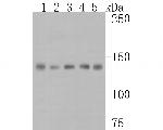 Met (c-Met) Antibody in Western Blot (WB)