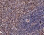 CD105 Antibody in Immunohistochemistry (Paraffin) (IHC (P))