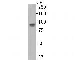CD105 Antibody in Western Blot (WB)