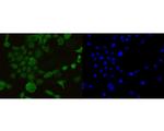 AIM2 Antibody in Immunocytochemistry (ICC/IF)
