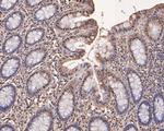 Triosephosphate isomerase Antibody in Immunohistochemistry (Paraffin) (IHC (P))