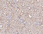 HNF1 alpha Antibody in Immunohistochemistry (Paraffin) (IHC (P))