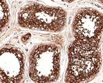 ChT1 Antibody in Immunohistochemistry (Paraffin) (IHC (P))