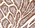 ChT1 Antibody in Immunohistochemistry (Paraffin) (IHC (P))