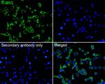 IL-2RG Antibody in Immunocytochemistry (ICC/IF)