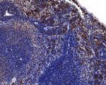IL-2RG Antibody in Immunohistochemistry (Paraffin) (IHC (P))