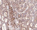 IL-2RG Antibody in Immunohistochemistry (Paraffin) (IHC (P))