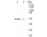 IL-2RG Antibody in Western Blot (WB)