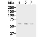 CPN1 Antibody in Western Blot (WB)