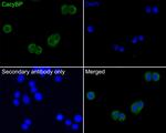 CacyBP Antibody in Immunocytochemistry (ICC/IF)