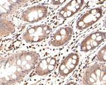 CacyBP Antibody in Immunohistochemistry (Paraffin) (IHC (P))