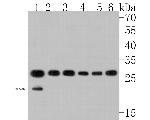 CacyBP Antibody in Western Blot (WB)