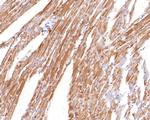 KCNIP2 Antibody in Immunohistochemistry (Paraffin) (IHC (P))