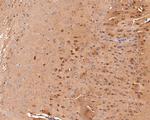 KCNIP2 Antibody in Immunohistochemistry (Paraffin) (IHC (P))