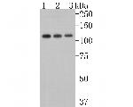 USP15 Antibody in Western Blot (WB)