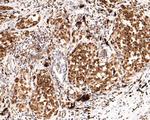 SOX10 Antibody in Immunohistochemistry (Paraffin) (IHC (P))