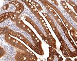 Villin1 Antibody in Immunohistochemistry (Paraffin) (IHC (P))