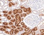 Villin1 Antibody in Immunohistochemistry (Paraffin) (IHC (P))
