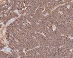 Chromogranin A Antibody in Immunohistochemistry (Paraffin) (IHC (P))