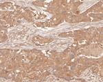 Cytokeratin 18 Antibody in Immunohistochemistry (Paraffin) (IHC (P))