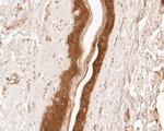 Cytokeratin 18 Antibody in Immunohistochemistry (Paraffin) (IHC (P))