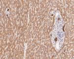 Cytokeratin 18 Antibody in Immunohistochemistry (Paraffin) (IHC (P))