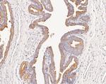 Cytokeratin 18 Antibody in Immunohistochemistry (Paraffin) (IHC (P))