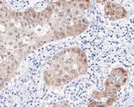 p16INK4a Antibody in Immunohistochemistry (Paraffin) (IHC (P))