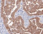 p16INK4a Antibody in Immunohistochemistry (Paraffin) (IHC (P))