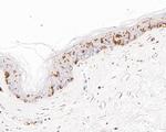 CD1A Antibody in Immunohistochemistry (Paraffin) (IHC (P))