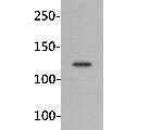 IGF1R Antibody in Western Blot (WB)