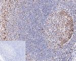 Histone H3 (acetyl K27) Antibody in Immunohistochemistry (Paraffin) (IHC (P))