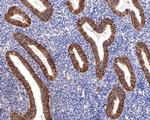 CD166 Antibody in Immunohistochemistry (Paraffin) (IHC (P))