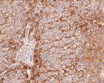 CD166 Antibody in Immunohistochemistry (Paraffin) (IHC (P))