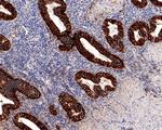 CD166 Antibody in Immunohistochemistry (Paraffin) (IHC (P))