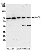 HACL1 Polyclonal Antibody