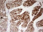 HADH Antibody in Immunohistochemistry (Paraffin) (IHC (P))