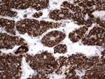 HADH Antibody in Immunohistochemistry (Paraffin) (IHC (P))
