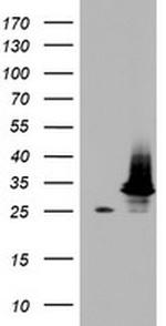 HADH Antibody in Western Blot (WB)
