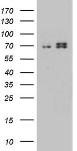 HADHA Antibody in Western Blot (WB)